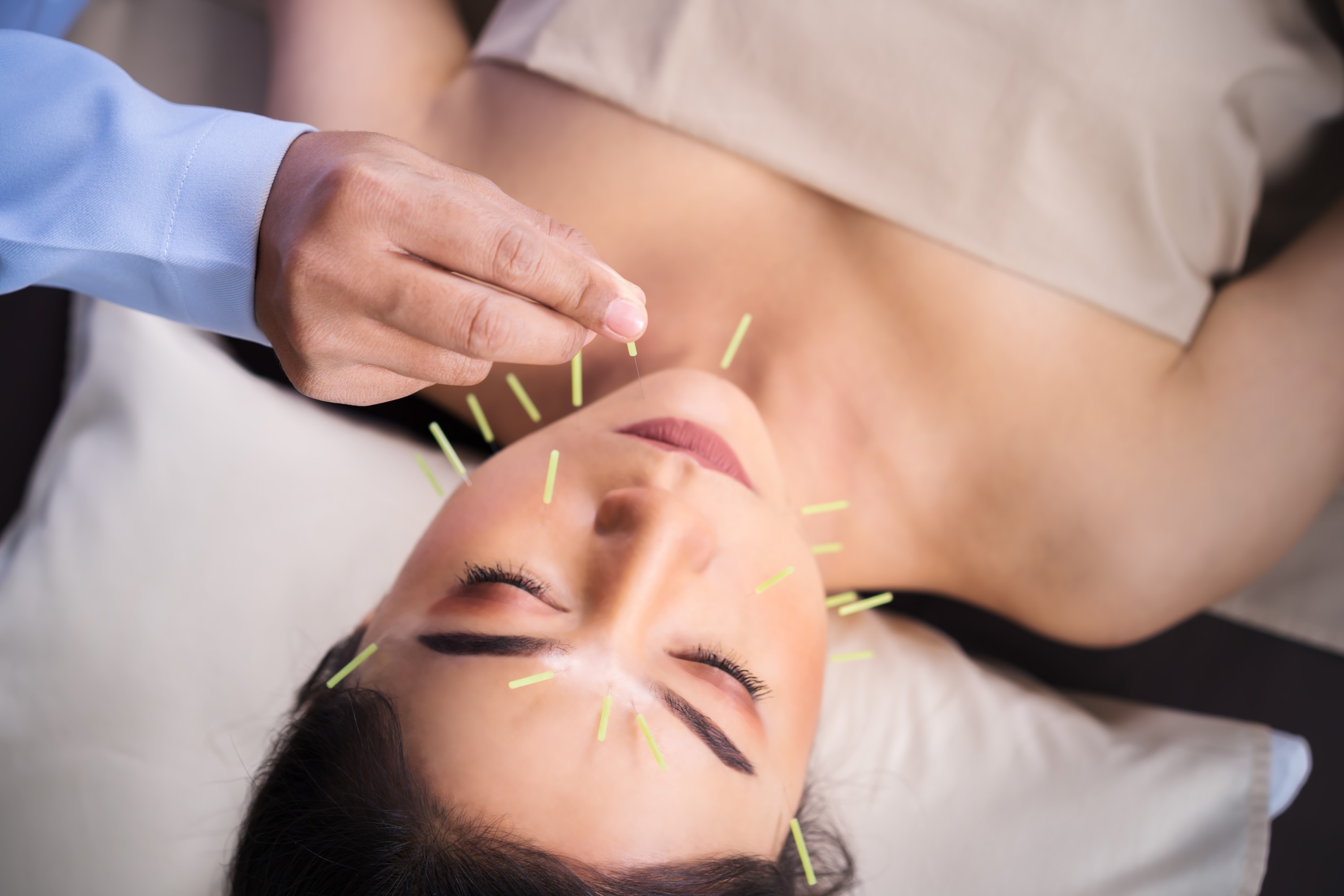 Facial Acupuncture Facial Acupuncture