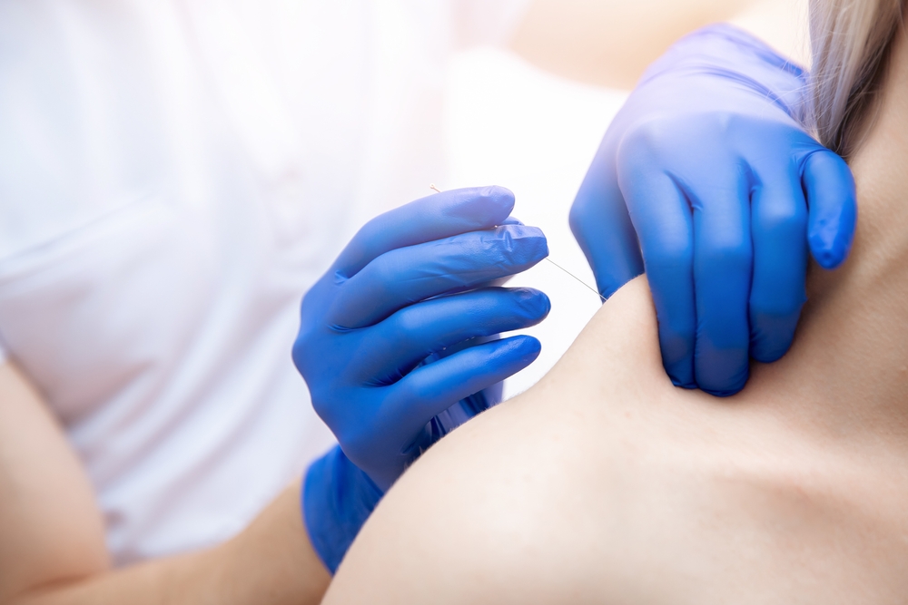 Upper shoulder needle Upper shoulder needle